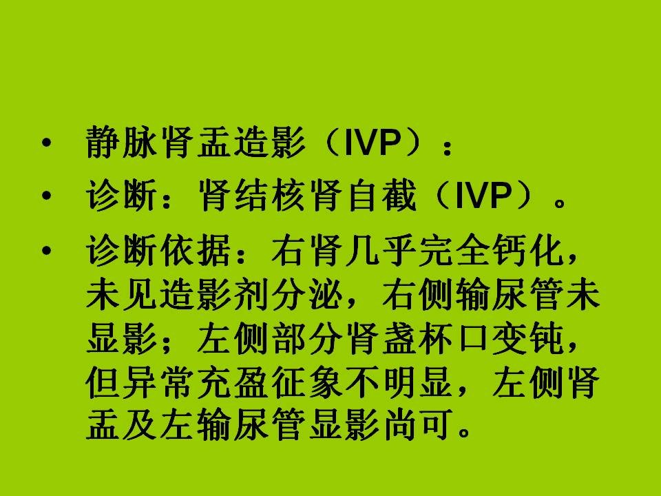 硬膜下血肿影像3